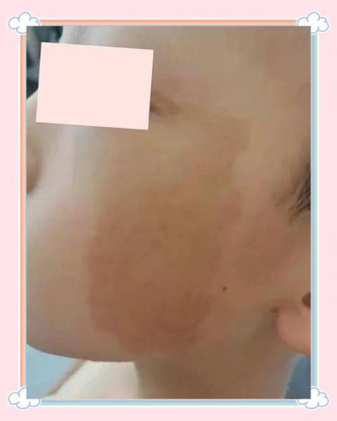 胎记是自己的生肖属相（胎记是自己的生肖属相吗😴）