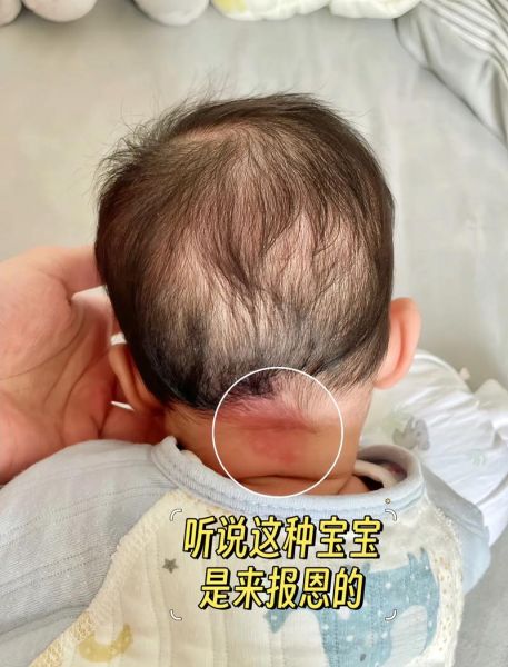 胎记是自己的生肖属相（胎记是自己的生肖属相吗😴）